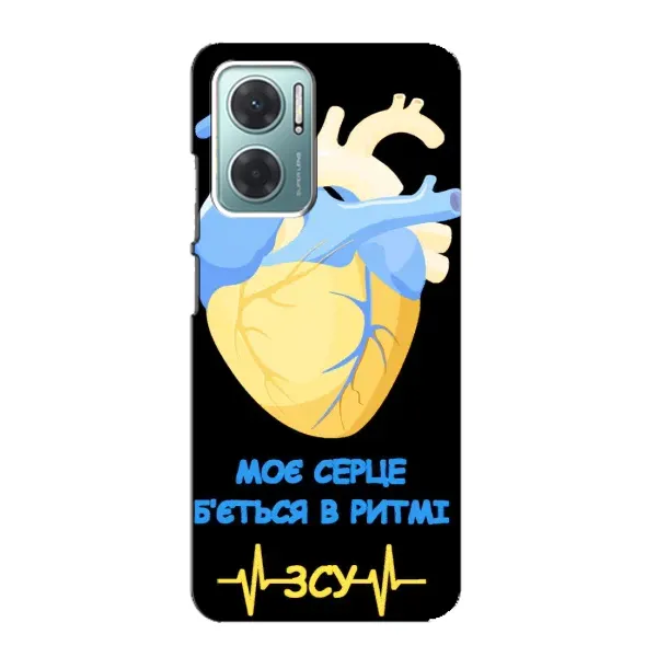 Чехол с рисунком «Ритм ЗСУ» для Xiaomi Redmi Note 11E Чехол с рисунком «Ритм ЗСУ» для Xiaomi Redmi Note 11E