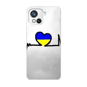 Силиконовый Чехол на Blackview Oscal C80 (Я-Украина) (Украинская кардиограмма)