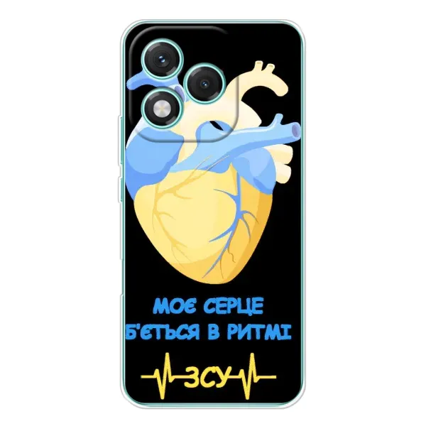 Чехол с рисунком «Ритм ЗСУ» для Huawei Honor 400 Lite Чехол с рисунком «Ритм ЗСУ» для Huawei Honor 400 Lite