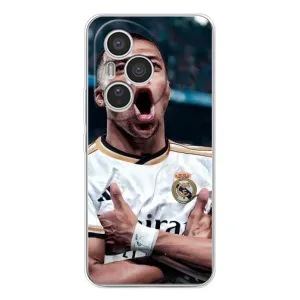 Чохол (TPU) з Футболістом на Huawei Honor 400 Pro (Гол Мбаппе)