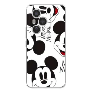 Чехлы с принтом Микки Маус на Huawei Honor 400 Pro (Мордочка Маус)