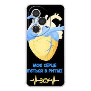 ЗСУ Чехлы (TPU) для Huawei Honor 400 Pro (Ритм ЗСУ)
