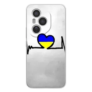 Силиконовый Чехол на Huawei Honor 400 Pro (Я-Украина) (Украинская кардиограмма)