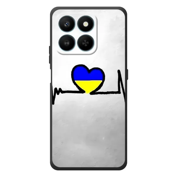 Чехол с рисунком «Украинская кардиограмма» для Huawei Honor 400 Smart Чехол с рисунком «Украинская кардиограмма» для Huawei Honor 400 Smart