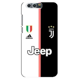 Чехлы с ТОП Футбольными клубами на Huawei Honor 9, Glory 9, STF (Juventus)
