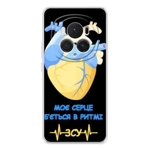 ЗСУ Чехлы (TPU) для Huawei Honor Magic 7 Pro