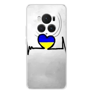 Силиконовый Чехол на Huawei Honor Magic 7 Pro (Я-Украина) (Украинская кардиограмма)