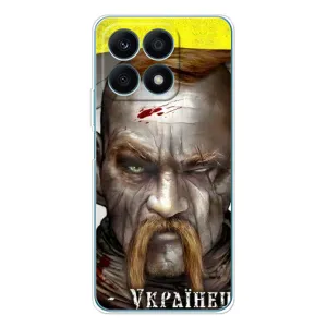 Чохол з картинкою (Патріотичний КОЗАК) на Huawei Honor X8a (Одноокий КОЗАК)