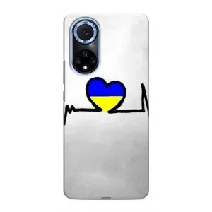 Силіконовий Чохол на Huawei Nova 9 SE (Я-Україна) (Українська кардіограма)