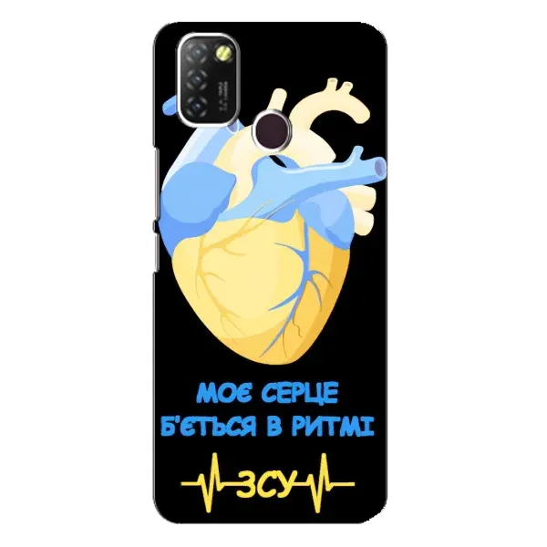 Чехол с рисунком «Ритм ЗСУ» для Infinix Hot 10 Lite Чехол с рисунком «Ритм ЗСУ» для Infinix Hot 10 Lite