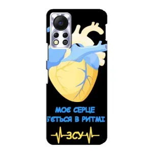 ЗСУ Чохли (TPU) для Infinix Hot 11s (Ритм ЗСУ)