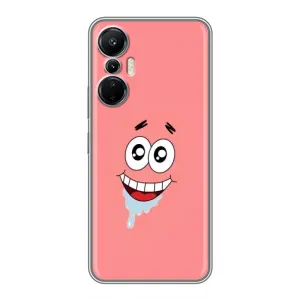 Чехлы с Патриком на Infinix Hot 20 (4G) (Мордочка Патрика)