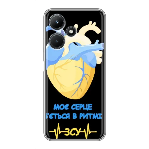 Чехол с рисунком «Ритм ЗСУ» для Infinix Hot 30i Чехол с рисунком «Ритм ЗСУ» для Infinix Hot 30i