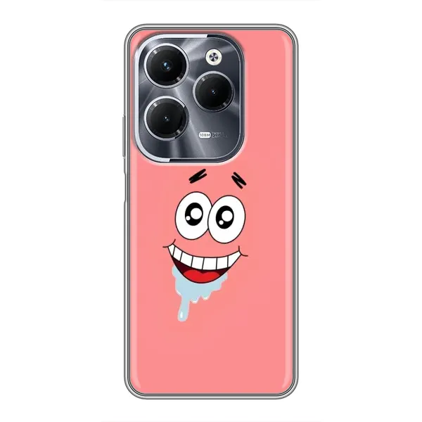 Чехол с рисунком «Мордочка Патрика» для Infinix Hot 40 Pro Чехол с рисунком «Мордочка Патрика» для Infinix Hot 40 Pro