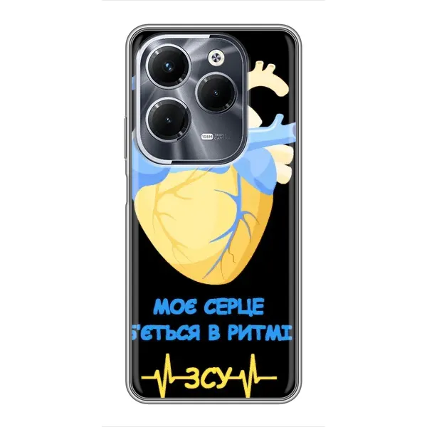 Чехол с рисунком «Ритм ЗСУ» для Infinix Hot 40 Pro Чехол с рисунком «Ритм ЗСУ» для Infinix Hot 40 Pro