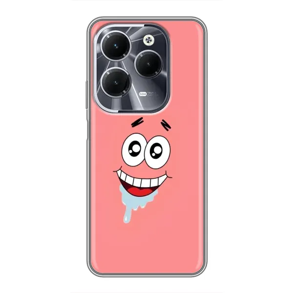 Чехол с рисунком «Мордочка Патрика» для Infinix Hot 40 Чехол с рисунком «Мордочка Патрика» для Infinix Hot 40