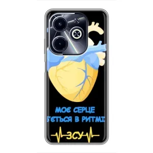 ЗСУ Чехлы (TPU) для Infinix Hot 40i (Ритм ЗСУ)