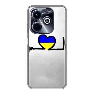 Силиконовый Чехол на Infinix Hot 40i (Я-Украина) (Украинская кардиограмма)