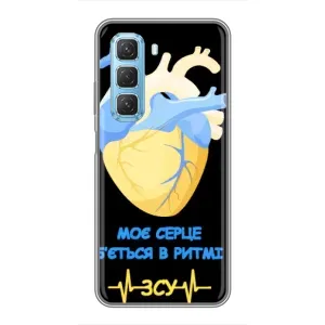 ЗСУ Чехлы (TPU) для Infinix Hot 50 5G (Ритм ЗСУ)