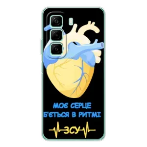 ЗСУ Чехлы (TPU) для Infinix Hot 50 (Ритм ЗСУ)
