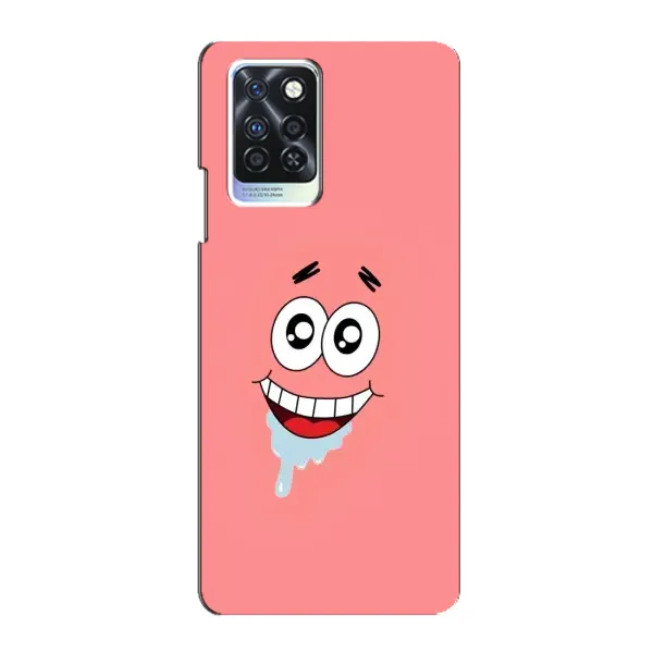 Чехол с рисунком «Мордочка Патрика» для Infinix Note 10 Pro Чехол с рисунком «Мордочка Патрика» для Infinix Note 10 Pro