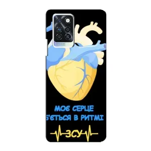 ЗСУ Чехлы (TPU) для Infinix Note 10 Pro (Ритм ЗСУ)