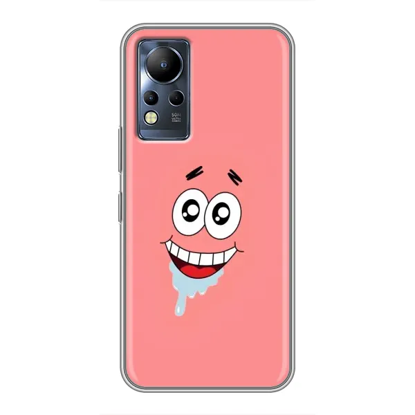 Чехол с рисунком «Мордочка Патрика» для Infinix Note 11 Чехол с рисунком «Мордочка Патрика» для Infinix Note 11