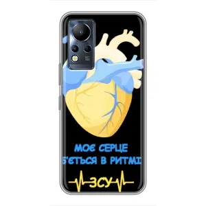 ЗСУ Чохли (TPU) для Infinix Note 12 (Ритм ЗСУ)