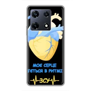 ЗСУ Чохли (TPU) для Infinix Note 30 Pro (Ритм ЗСУ)