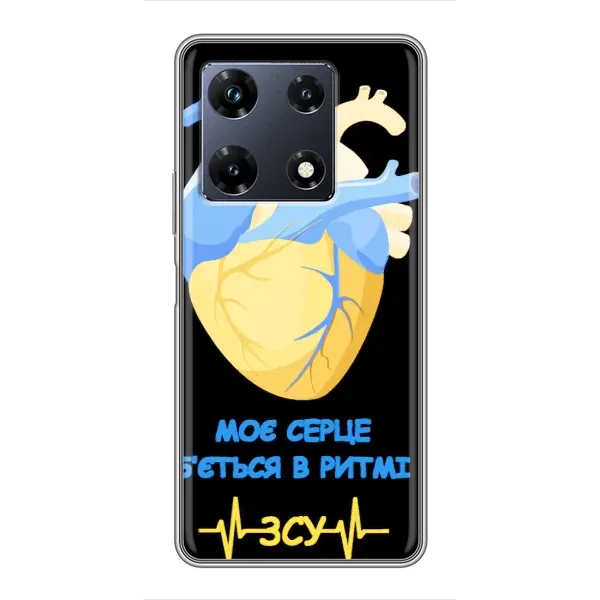 Чехол с рисунком «Ритм ЗСУ» для Infinix Note 30 Pro Чехол с рисунком «Ритм ЗСУ» для Infinix Note 30 Pro