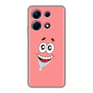 Чохли з Патріком на Infinix Note 30 (Мордочка Патріка)