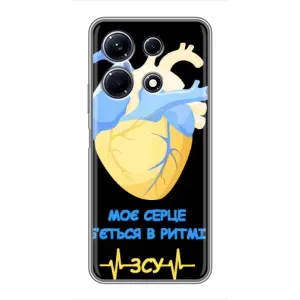 ЗСУ Чехлы (TPU) для Infinix Note 30 (Ритм ЗСУ)