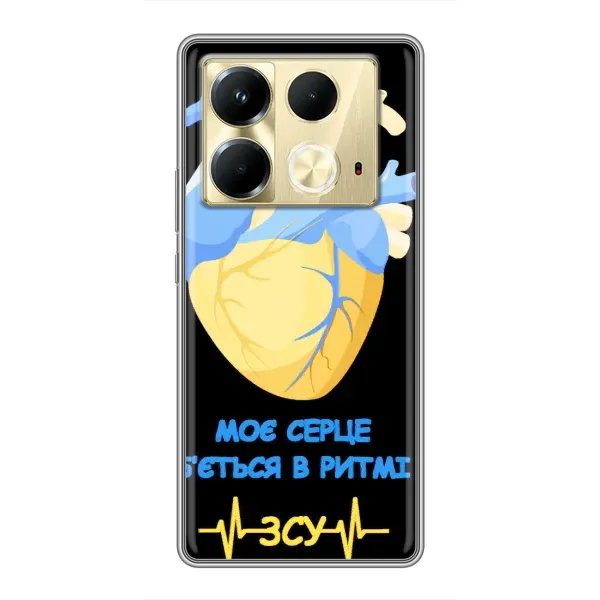 Чехол с рисунком «Ритм ЗСУ» для Infinix Note 40 Чехол с рисунком «Ритм ЗСУ» для Infinix Note 40