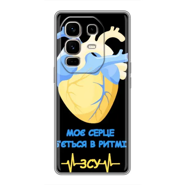 Чехол с рисунком «Ритм ЗСУ» для Infinix Note 50 Pro Plus Чехол с рисунком «Ритм ЗСУ» для Infinix Note 50 Pro Plus