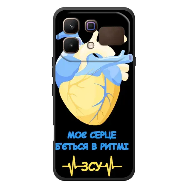 Чехол с рисунком «Ритм ЗСУ» для Infinix Note 60 Чехол с рисунком «Ритм ЗСУ» для Infinix Note 60