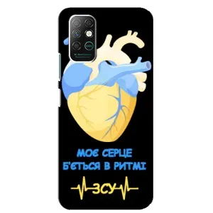 ЗСУ Чехлы (TPU) для Infinix Note 8