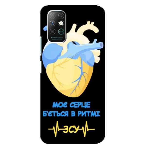 Чехол с рисунком «Ритм ЗСУ» для Infinix Note 8 Чехол с рисунком «Ритм ЗСУ» для Infinix Note 8