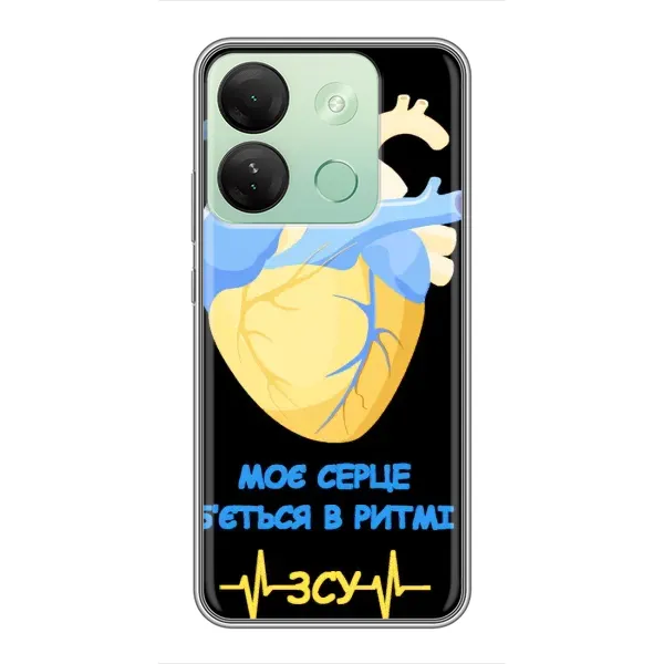 Чехол с рисунком «Ритм ЗСУ» для Infinix Smart 7 HD Чехол с рисунком «Ритм ЗСУ» для Infinix Smart 7 HD