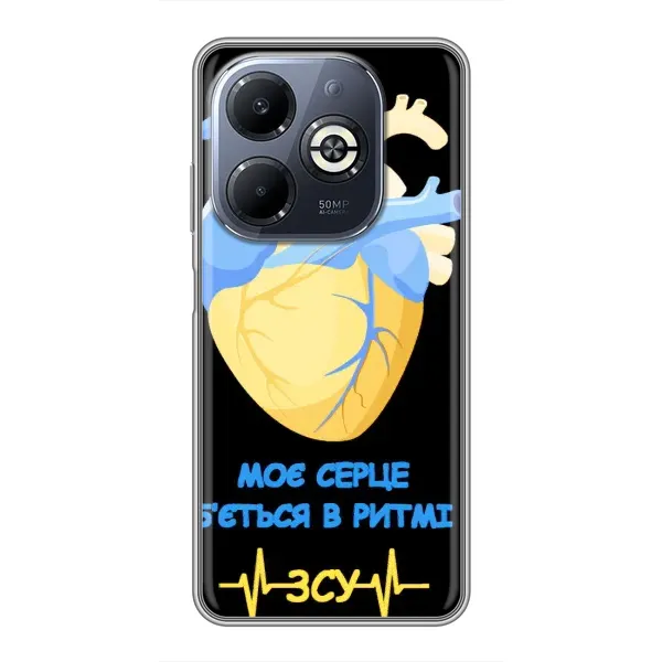 Чехол с рисунком «Ритм ЗСУ» для Infinix Smart 8 Plus Чехол с рисунком «Ритм ЗСУ» для Infinix Smart 8 Plus
