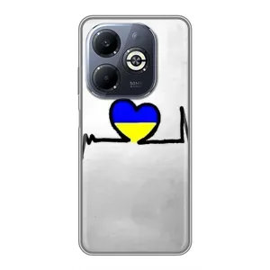 Силиконовый Чехол на Infinix Smart 8 Plus (Я-Украина) (Украинская кардиограмма)