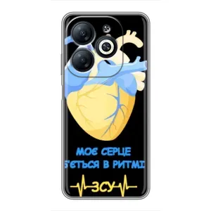 ЗСУ Чехлы (TPU) для Infinix Smart 8 (Ритм ЗСУ)