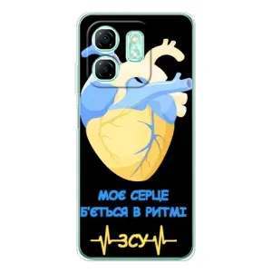 ЗСУ Чехлы (TPU) для Infinix Smart 9