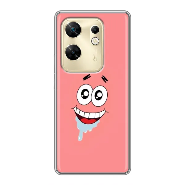 Чехол с рисунком «Мордочка Патрика» для Infinix Zero 30 Чехол с рисунком «Мордочка Патрика» для Infinix Zero 30