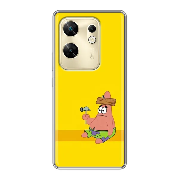 Чехол с рисунком «Ошибочка» для Infinix Zero 30 Чехол с рисунком «Ошибочка» для Infinix Zero 30