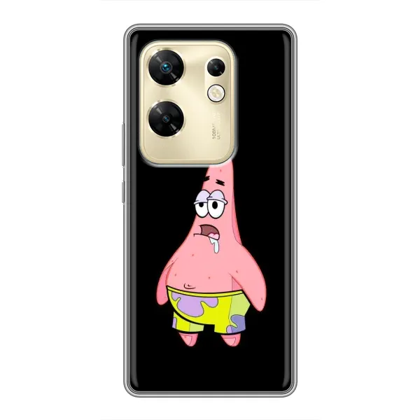 Чехол с рисунком «Патрик завис» для Infinix Zero 30 Чехол с рисунком «Патрик завис» для Infinix Zero 30
