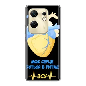 ЗСУ Чехлы (TPU) для Infinix Zero 30