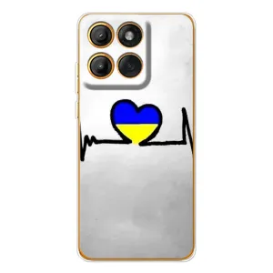 Силиконовый Чехол на Motorola Edge 60 Pro (Я-Украина) (Украинская кардиограмма)