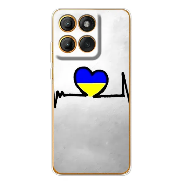 Чехол с рисунком «Украинская кардиограмма» для Motorola Edge 60 Pro Чехол с рисунком «Украинская кардиограмма» для Motorola Edge 60 Pro