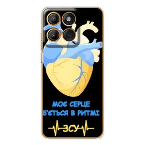 ЗСУ Чехлы (TPU) для Motorola Edge 60 (Ритм ЗСУ)
