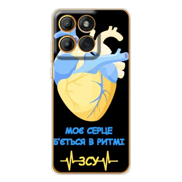 Чехол с рисунком «Ритм ЗСУ» для Motorola Edge 60 Чехол с рисунком «Ритм ЗСУ» для Motorola Edge 60